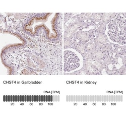 Carbohydrate Sulfotransferase 4/CHST4 Antibody, Novus Biologicals:Antibodies:Primary